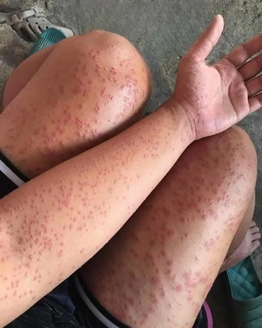 I stayed at my friend’s old apartment for a few days and started noticing these strange bumps — See more!
