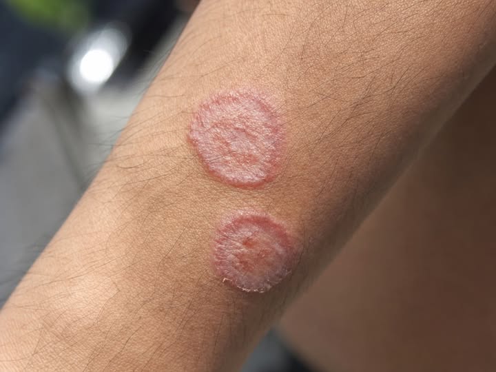 That Strange Rash Could Be a Life Threatening Warning Sign Doctors Say You Should Never Ignore