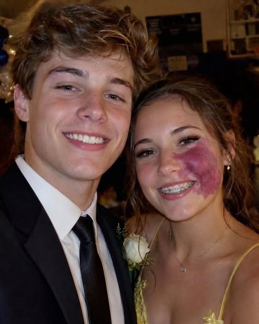 The Girl They Mocked for Her Birthmark Was Humiliated at Prom — Until Police Exposed the Truth Behind the “Perfect” Boy