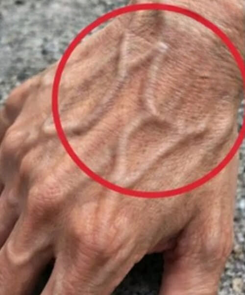When Your Veins Show Through the Skin, It Signifies… Does Having Prominent Veins Suggest Bad Blood Flow?