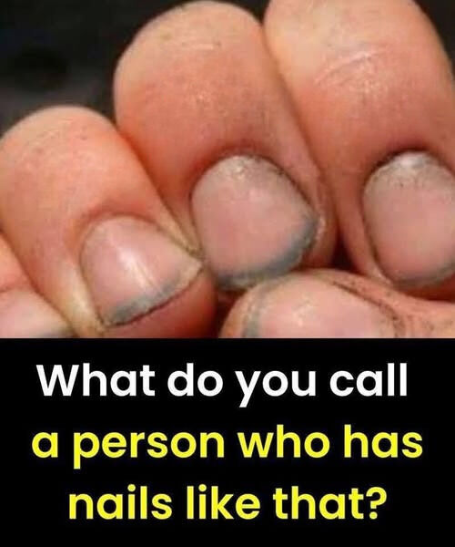 What Do Grimy Fingernails Genuinely Convey Regarding an Individual?