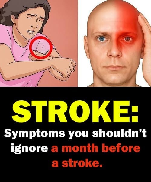 YOUR BODY MAY GIVE THESE WARNING SIGNS A MONTH BEFORE A STROKE — AND THEY CAN VARY BETWEEN MEN AND WOMEN