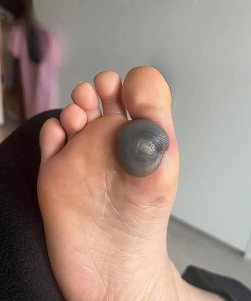 My female child awakened with this massive blemish on her lower extremity and I lack knowledge of what it could represent. She has been experiencing distress and lacks the capacity to adjust her foot, what constitutes this? Clarify this matter.