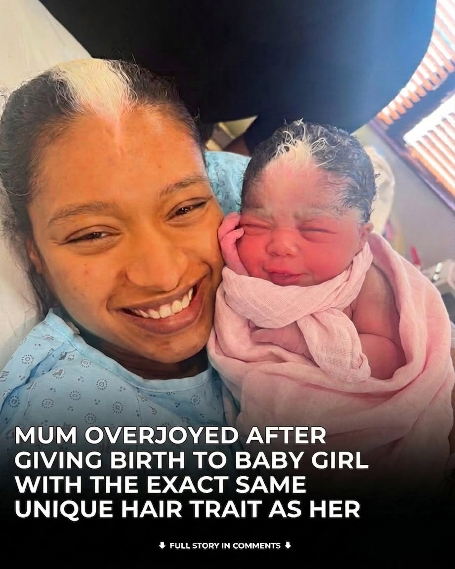 A Mother Was Overjoyed After Giving Birth to a Baby Girl—But What Shocked Her Most Was the Exact Same Rare Hair Trait They Both Shared