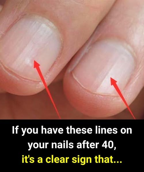 Foods That Support Stronger Nails After 40