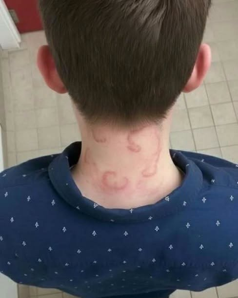 The Concealed Epidemic on Your Skin: Why That Itchy Red Circle Is a Signal You Must Not Overlook